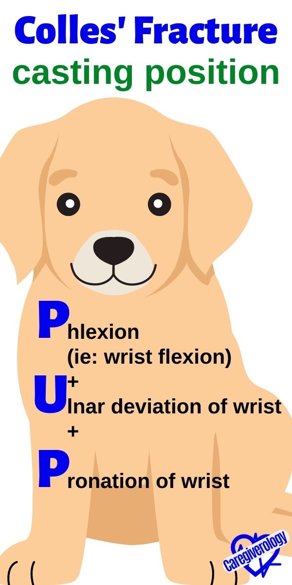 Colles' Fracture, casting position: PUP mnemonic