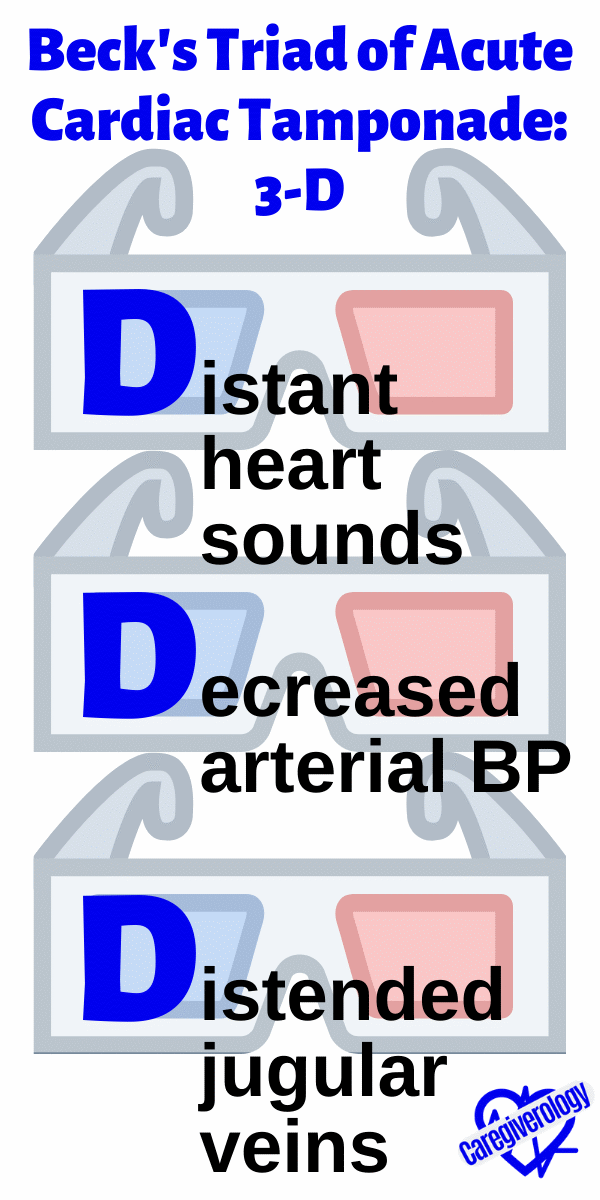 Beck's Triad of Acute Cardiac Tamponade: 3-D