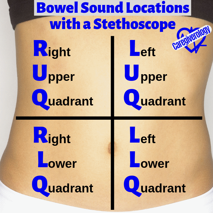 Bowel sound locations with a stethoscope