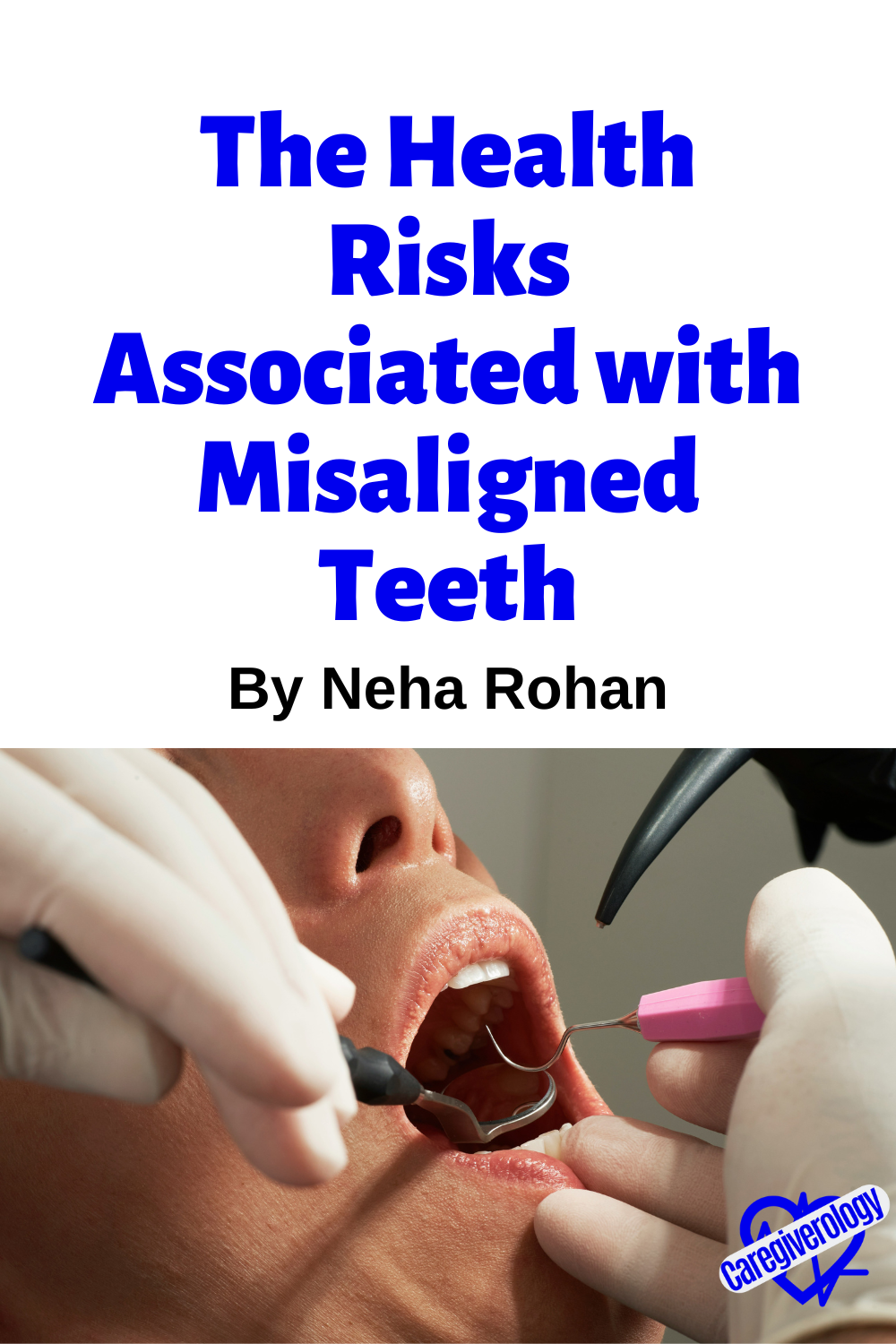 misaligned teeth pin