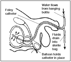 CBI system